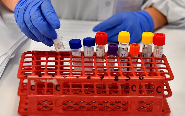 A lab assistant manipulates samples, at a COVID-19 screening centre of Saint Andre Hospital in Bordeaux, on May 20, 2020, as the hospital takes part in an operation of a screening and testing drive of the COVID-19 (novel coronavirus), organised in the city centre. (Photo by GEORGES GOBET / AFP)