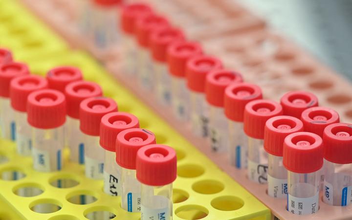 Samples awaiting testing for novel coronavirus Covid-19, are pictured at Biogroup Laboratory's lab in west London on January 21, 2021.