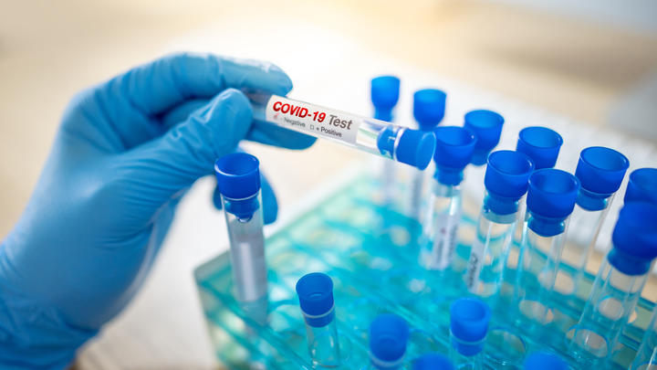 Medical scientist hand with blue sterile rubber gloves holding COVID-19 test tube in hospital laboratory. Male doctor or physician getting result of Coronavirus case.