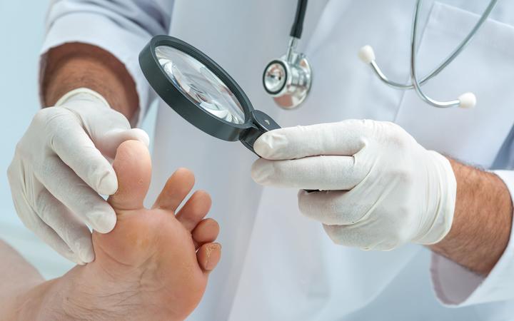 Doctor dermatologist examines the foot on the presence of athletes foot