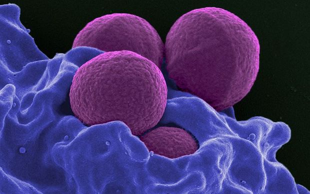 Human neutrophil ingesting Methicillin-resistant Staphylococcus aureus (MRSA), a bacteria that is resistant to many antibiotics.