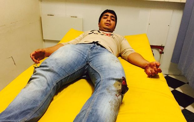 A Pakistani refugee on Nauru, Zijah, was left with severe cuts and extensive bruising from being knocked to the ground after being ambushed by locals.