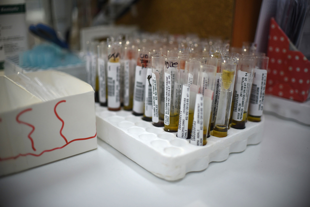 Tests for Zika