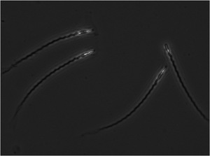 Sperm with long tadpole-like tails