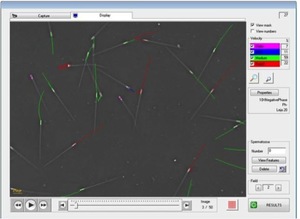 Sperm trails on a computer screen marked with multi-coloured lines