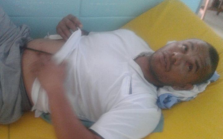 Ricardo Fisher spent two days in hospital in Suva, alleging he was beaten by police on Monday 24 October,2016
