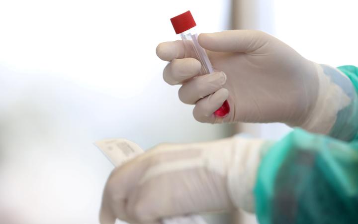 Medical staff member with mask and protective equipment holds Coronavirus nasal swabs test tubes at drive-through testing point in an effort to curb the spread of COVID-19 (novel coronavirus)