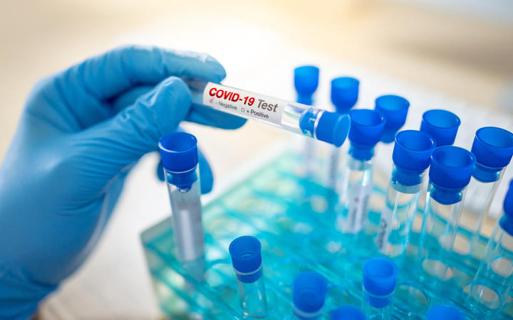 Medical scientist hand with blue sterile rubber gloves holding COVID-19 test tube in hospital laboratory. 