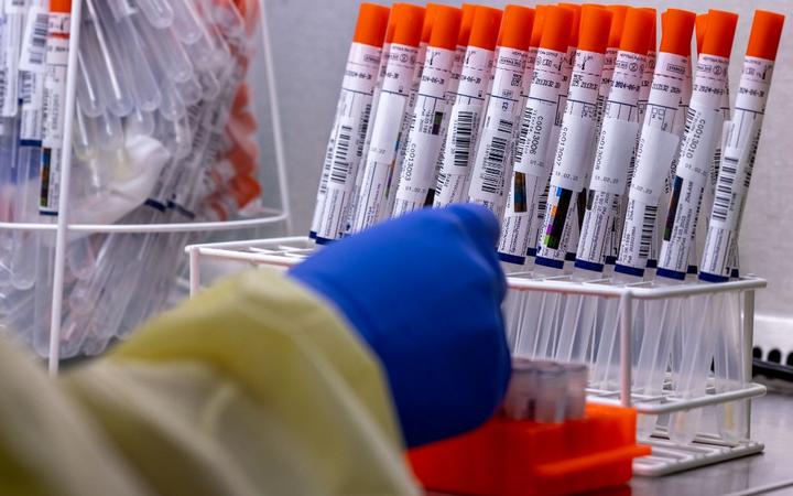 01 February 2022, Mecklenburg-Western Pomerania, Greifswald: Medical technical assistant Denise Dittmar pipettes swab samples from test centers and prepares them for further examination in the automated machine in the PCR laboratory 