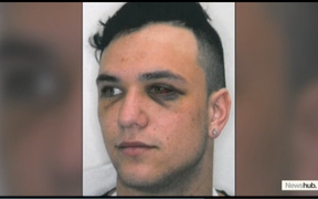 Newshub airs a Police photo of injuries sustained by one of Losi Filipo's four victims.