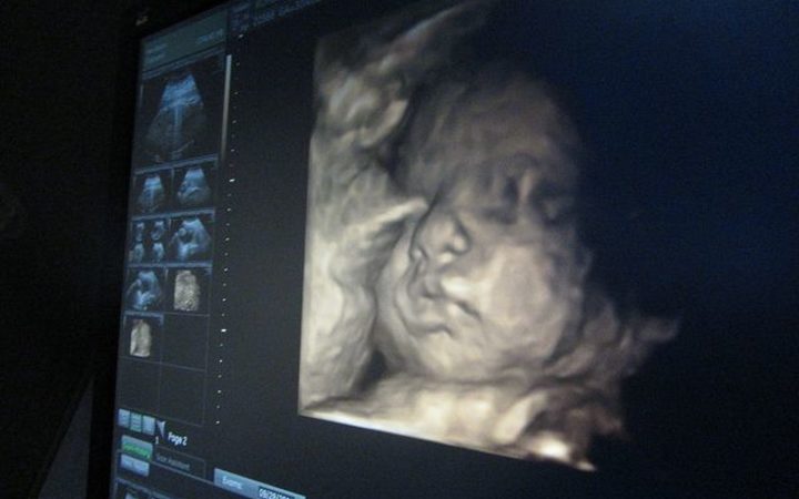 Baby Good 3d Ultrasound 