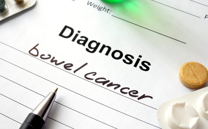 Bowel Cancer stock photo