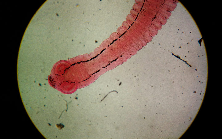 Close-up egg with adult parasite found with microscope in parasitology.