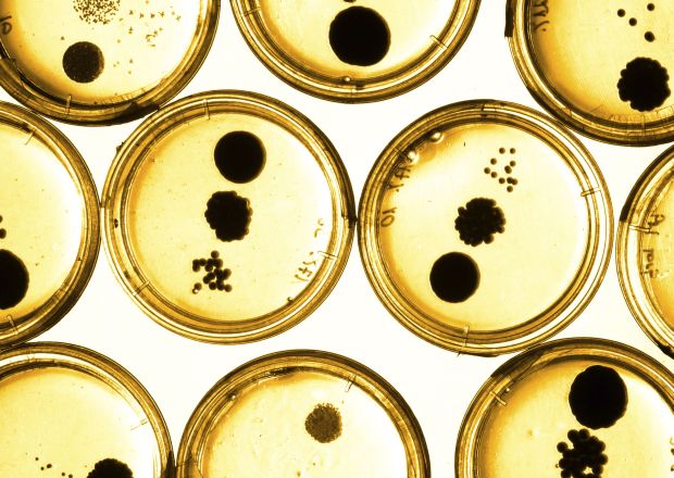 Yellow petri dish