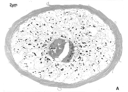 cross section showing melanin