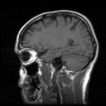 An MRI head scan