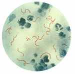 The streptococcus pyogenes bacteria which can lead to rheumatic fever